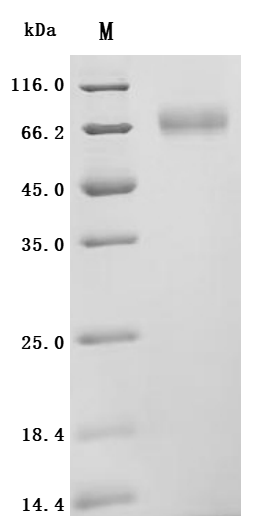 SDS-PAGE