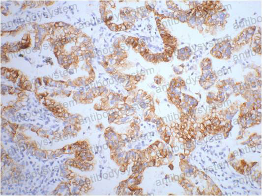 Валидация AntibodySystem RHC36103