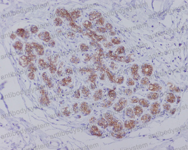 Валидация AntibodySystem RHD85602