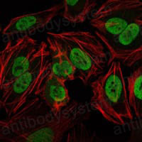 Валидация IF - AntibodySystem RHF68702