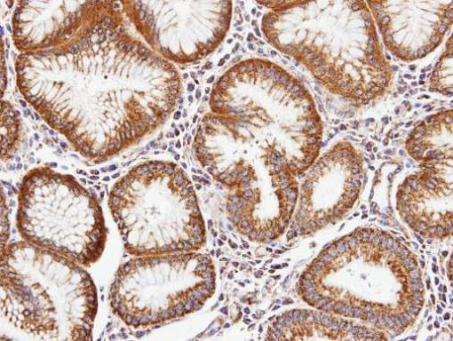 Валидация AssayVector ARM1431(1244)