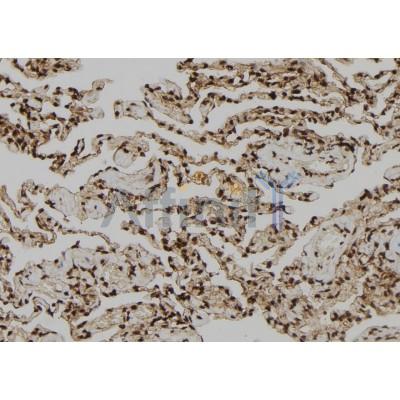 Валидация Affinity DF9998 - 23051