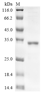 SDS-PAGE