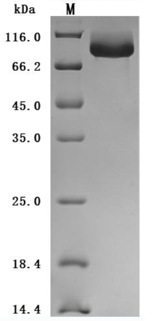 SDS-PAGE