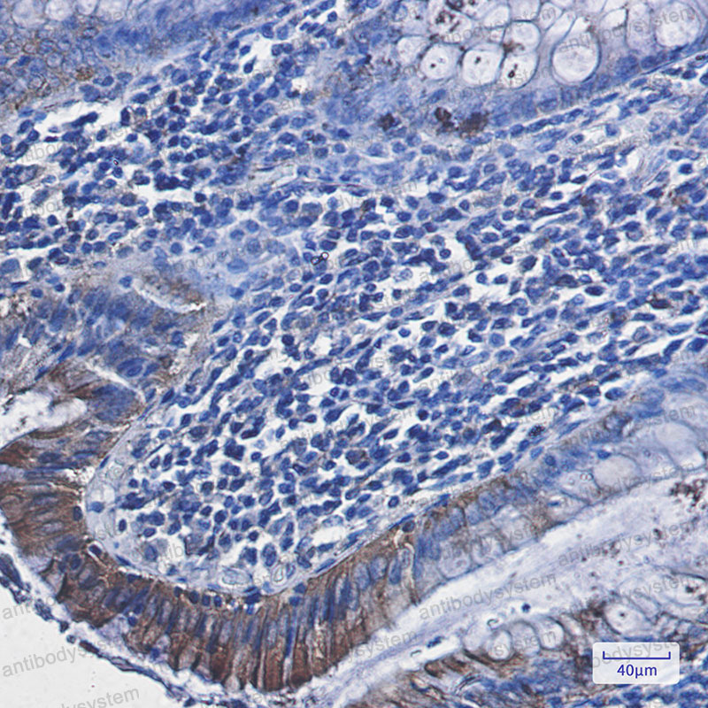 Валидация AntibodySystem RHN80601