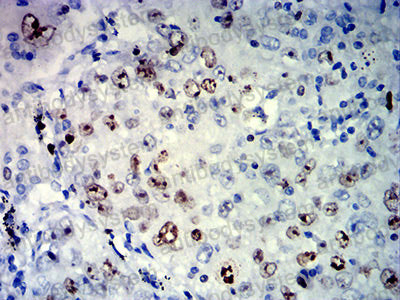 Валидация AntibodySystem RHE46101 (2178)