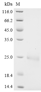 SDS-PAGE