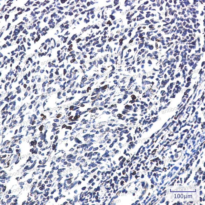 Валидация AntibodySystem RHN88901