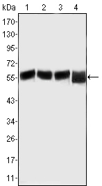 Валидация Affinity BF0456 - 5265