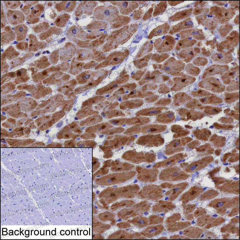 Валидация AntibodySystem RHJ57902