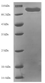 SDS-PAGE