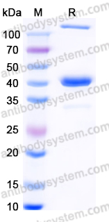 YHP21101, SDS-PAGE