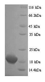 SDS-PAGE