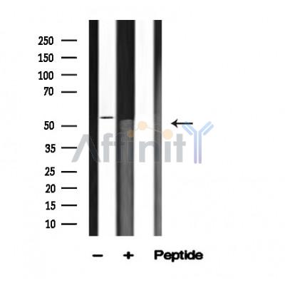 Валидация Affinity AF4618 - 2230