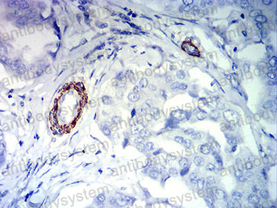 Валидация AntibodySystem RHF87803 (2717)