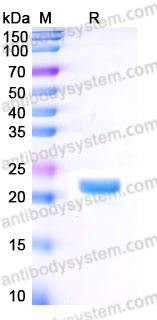EHB92504, SDS-PAGE