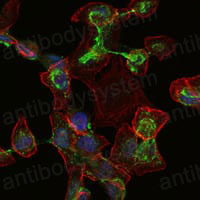 Валидация IF - AntibodySystem RHC06503