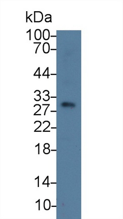 9532