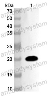 Валидация AntibodySystem PHA99401