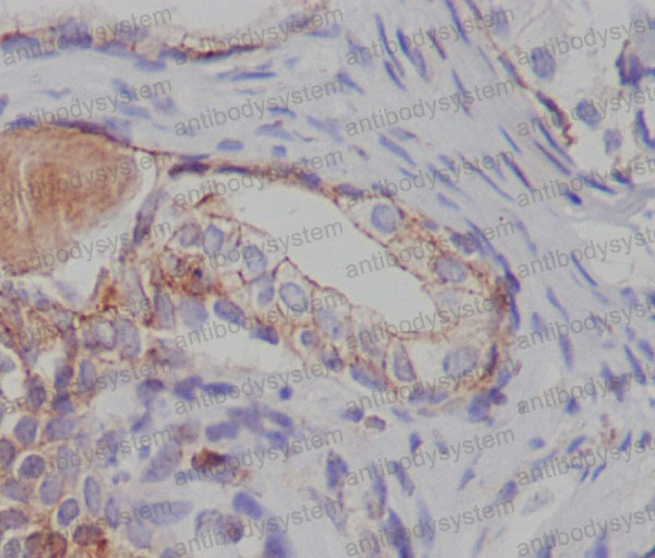 Валидация AntibodySystem RHE71804