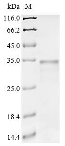 SDS-PAGE