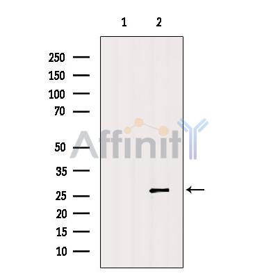 Валидация Affinity DF6121 - 17341