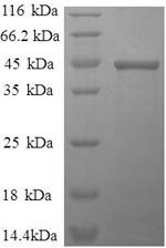 SDS-PAGE