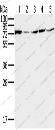 Вестерн-блоттинг, NDUFS1, клеточные линии 293T, PC3, HeLa, Jurkat и Raji