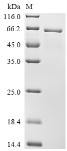 SDS-PAGE