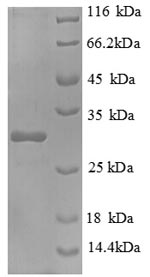 SDS-PAGE
