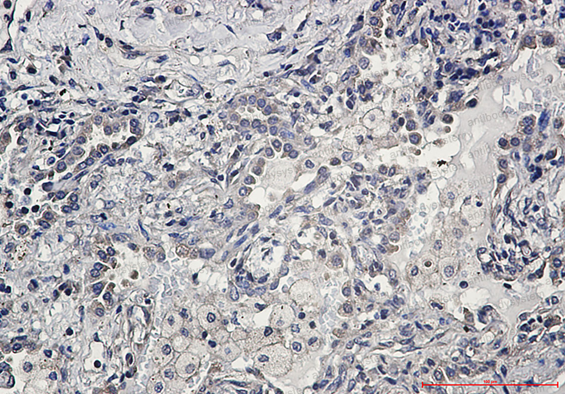 Валидация AntibodySystem RHD96509