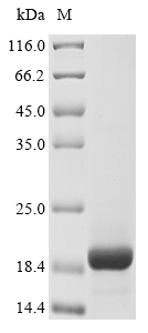 SDS-PAGE