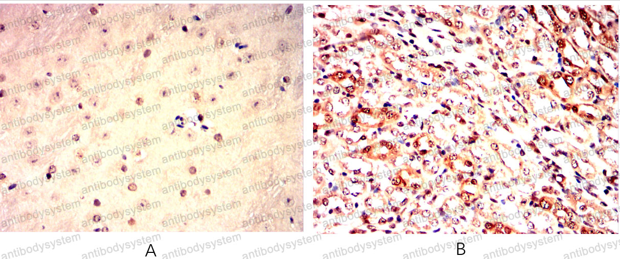 Валидация AntibodySystem RHD79503 (1825)