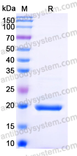 EHN56801, SDS-PAGE