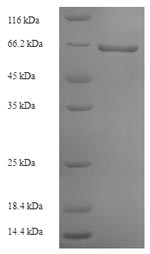 SDS-PAGE