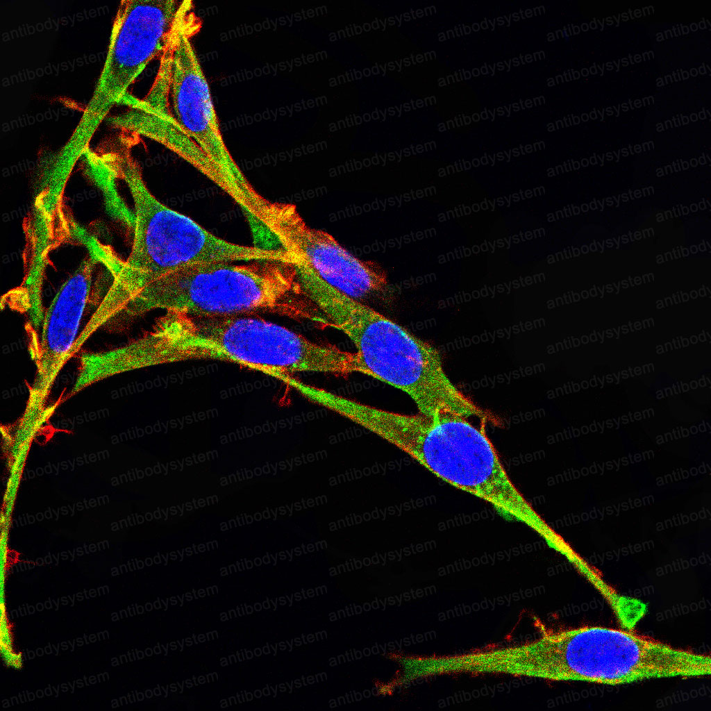 Валидация IF - AntibodySystem RHD53604 (655)
