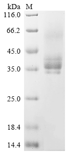 SDS-PAGE
