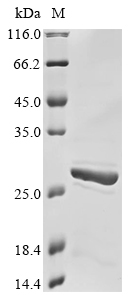 SDS-PAGE