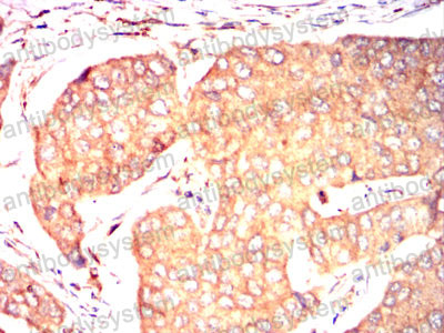 Валидация AntibodySystem RHJ43503