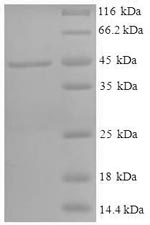 SDS-PAGE