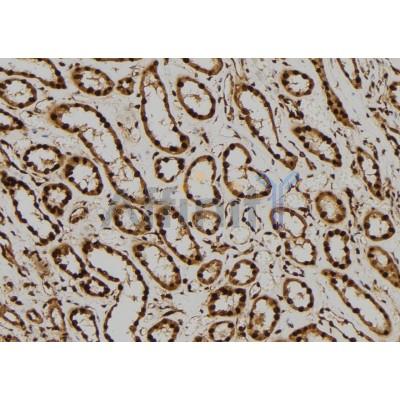 Валидация Affinity DF6032 - 17251