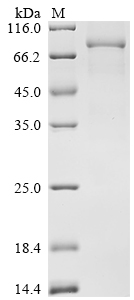 SDS-PAGE