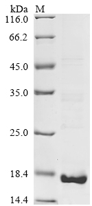 SDS-PAGE