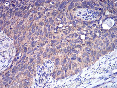 Валидация AntibodySystem RHN95201 (3988)