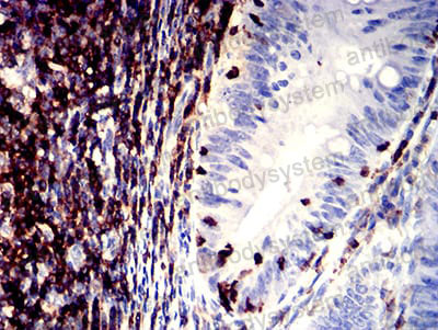 Валидация AntibodySystem RHD41004