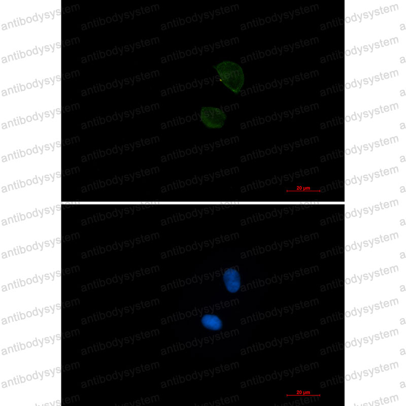 Валидация IF - AntibodySystem RHD03603