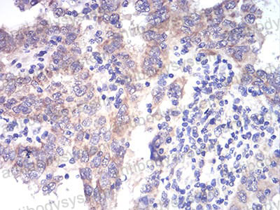 Валидация AntibodySystem RHF92802