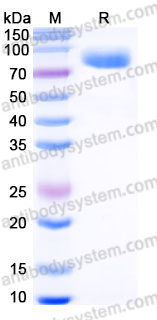EHJ25702, SDS-PAGE