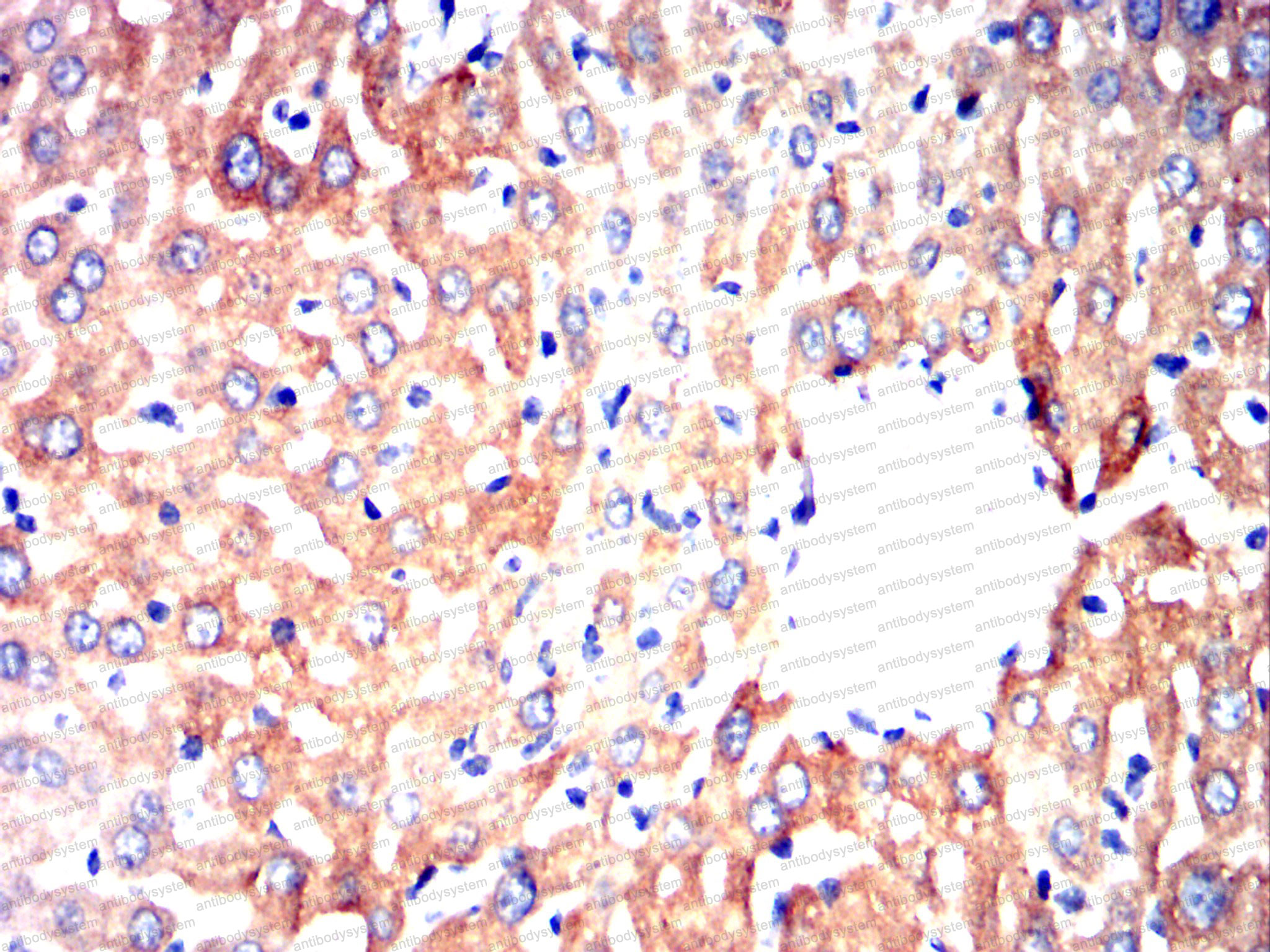 Валидация AntibodySystem RHC35402