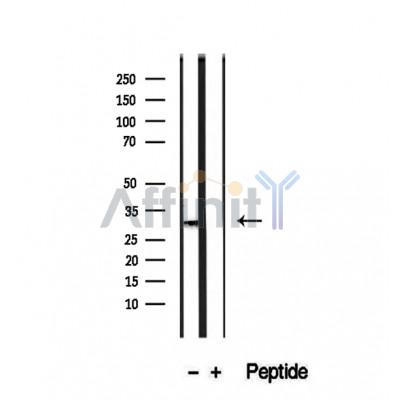Валидация Affinity DF12455 - 6993